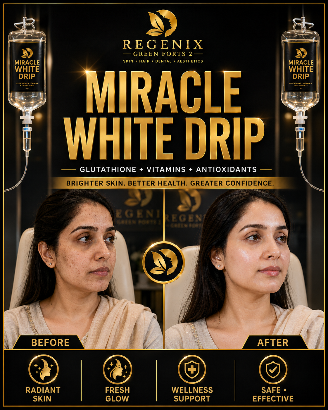Miracle White Drip — Before and After — Patient Result