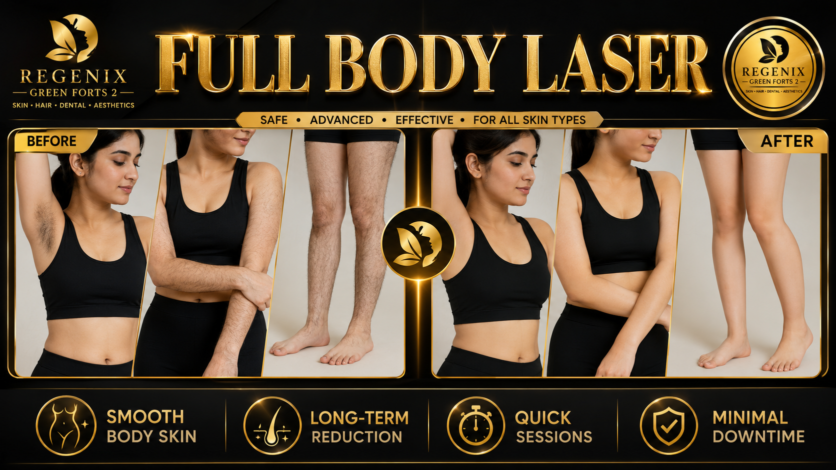 Full Body Laser