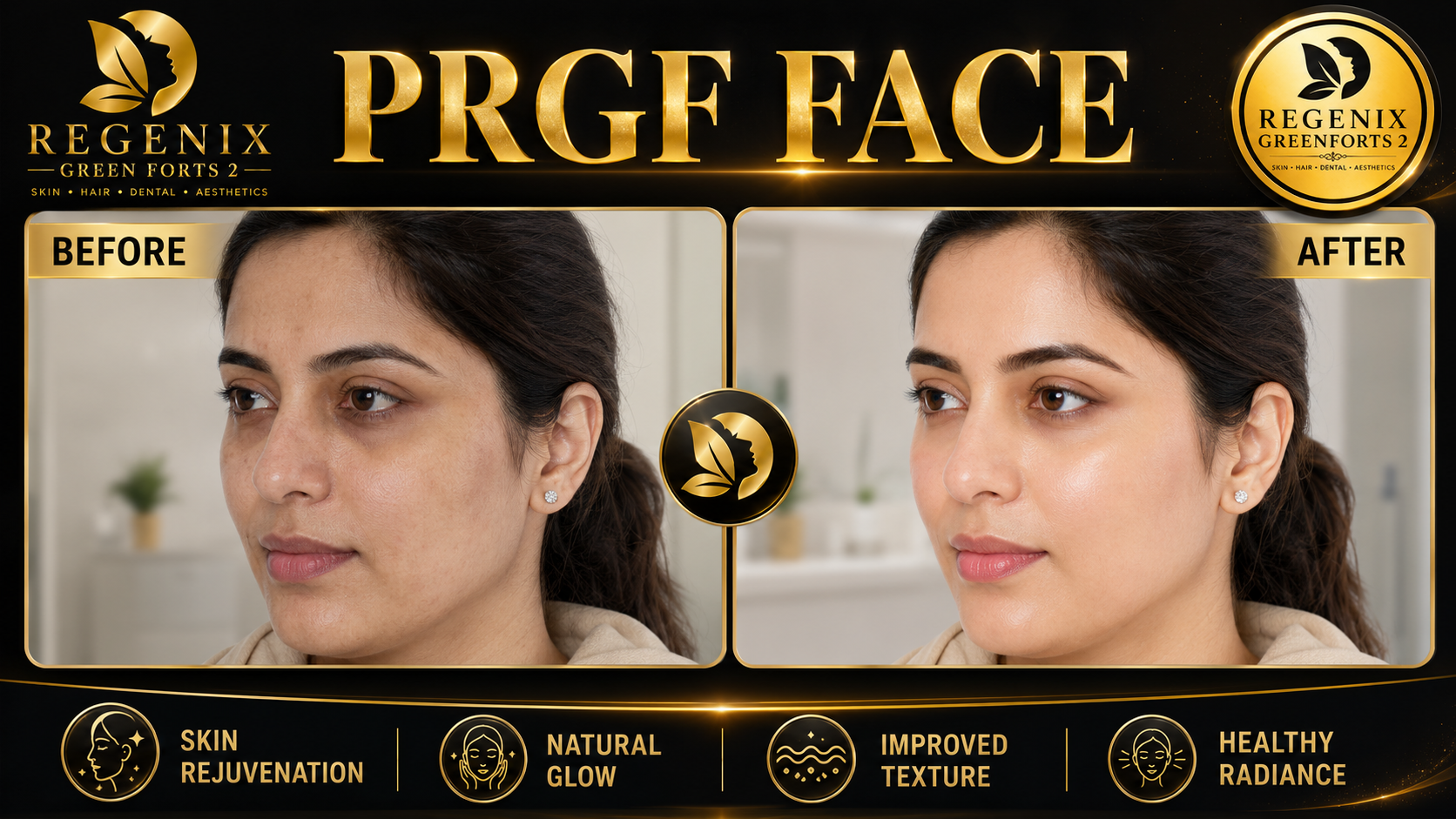PRGF Face visual reference