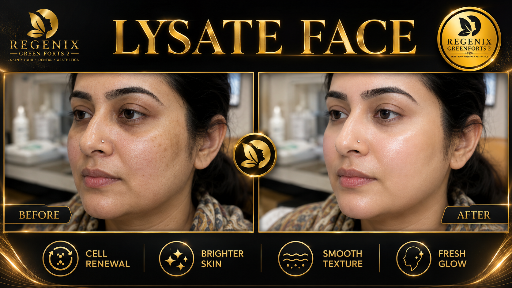 Lysate Face visual reference