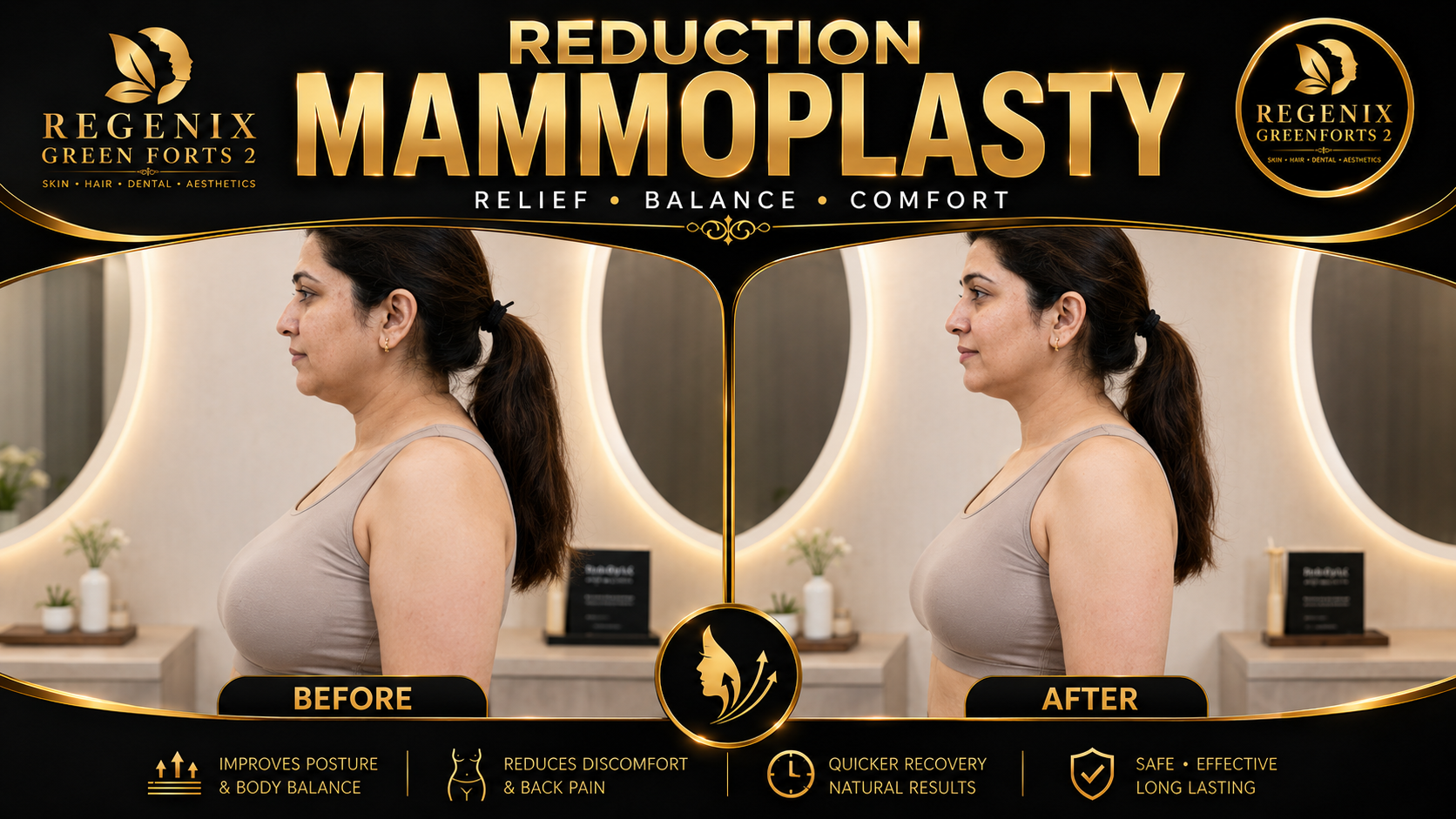 Reduction Mammoplasty visual reference