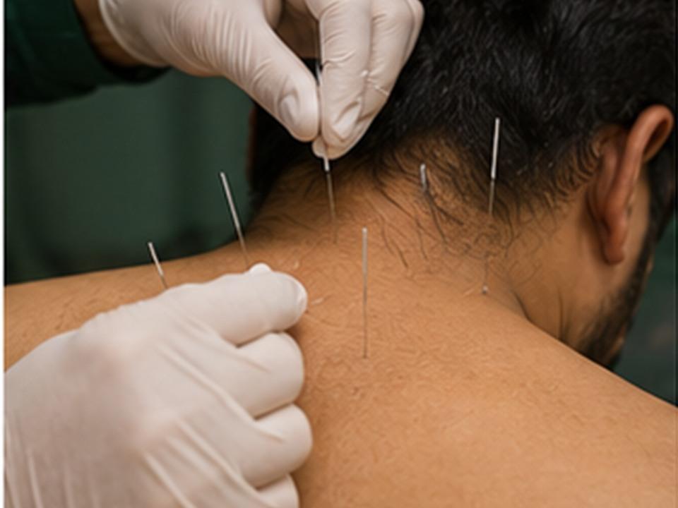 Dry Electro Needling rehabilitation at Regenix Green Fort