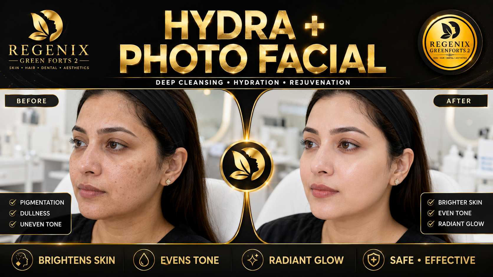 HydraFacial result — glowing skin after deep cleanse and hydration. Results vary.