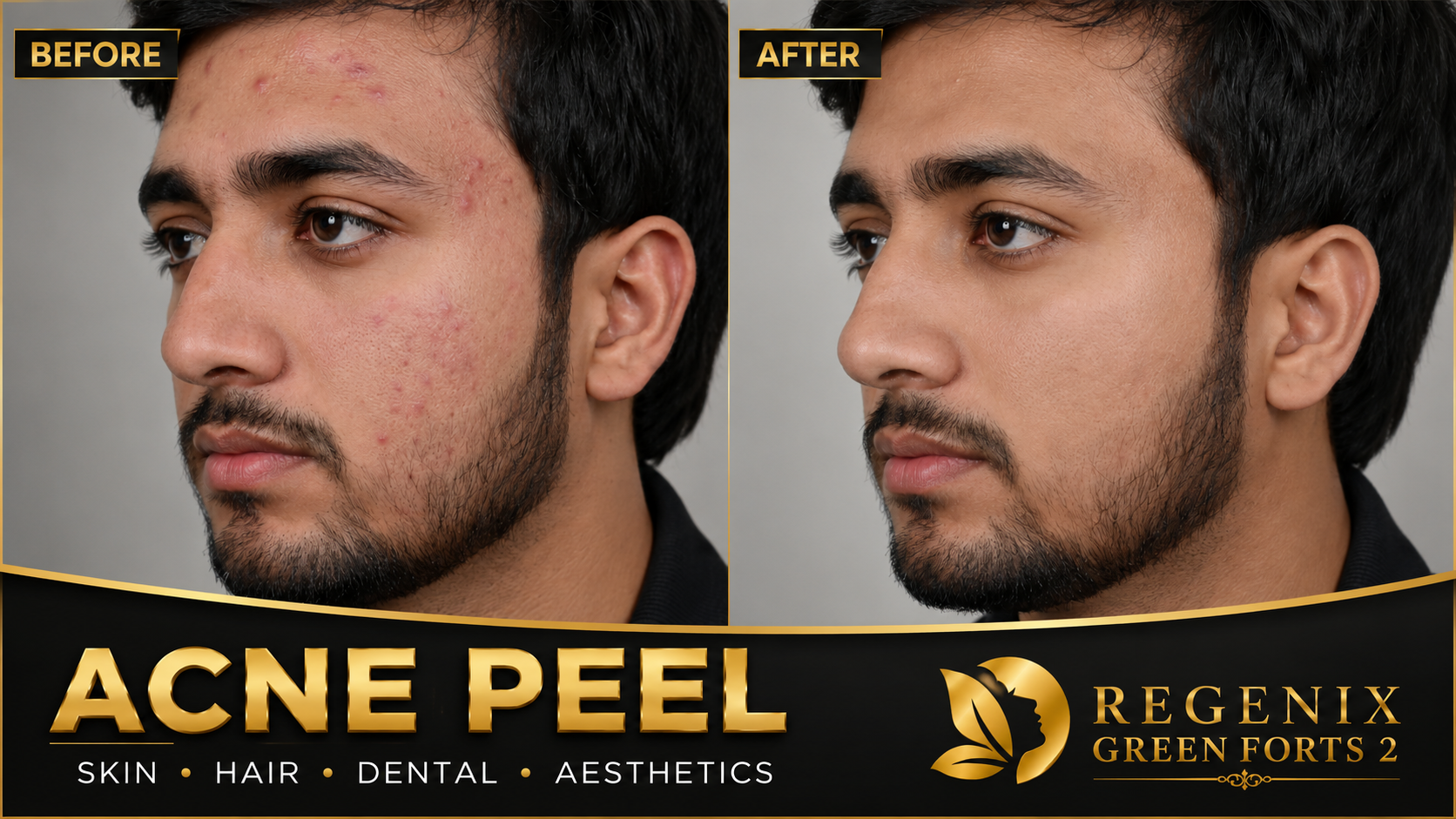 Pigmentation Review at Regenix Greenforts 2