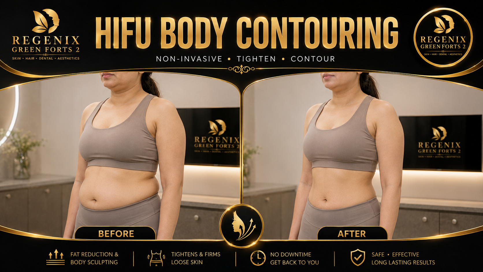 HIFU body planning