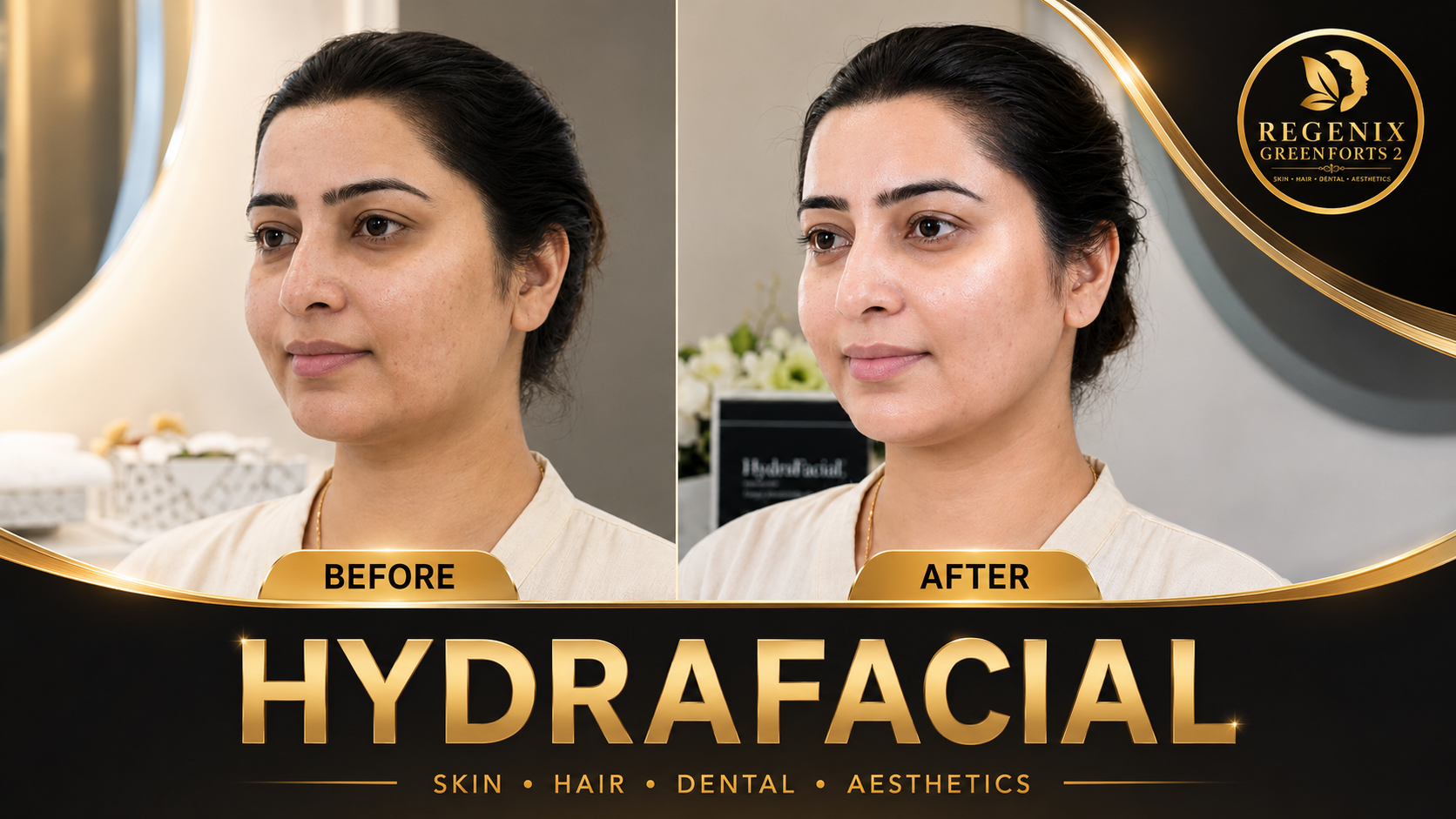 HydraFacial